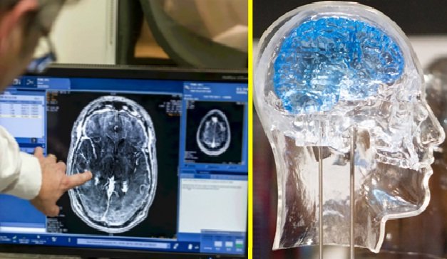 انعقاد تفاهم نامه انجمن تجهیزات پزشکی و آزمایشگاه نقشه برداری مغز