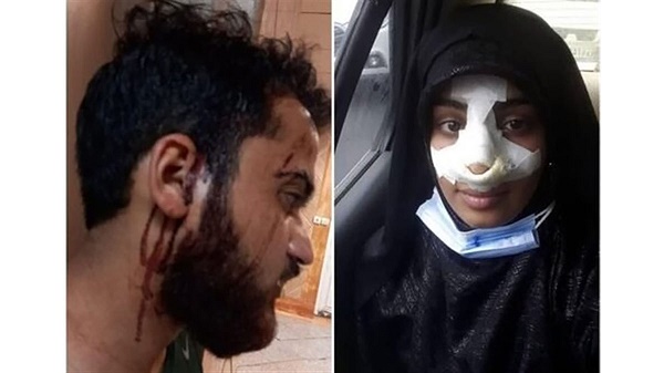 ضرب و شتم یک طلبه و همسرش در مهرشهر کرج+عکس