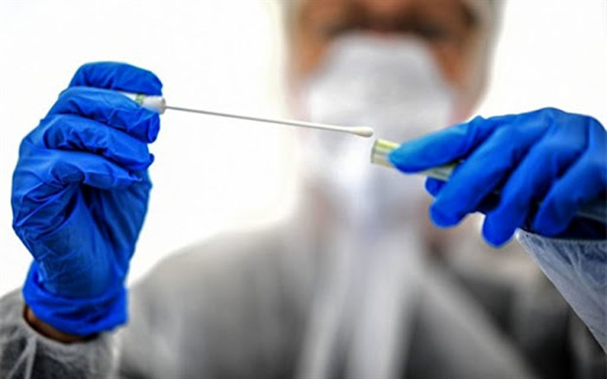 با بررسی  نمونه بزاق افراد احتمال ابتلای آنها به کووید شدید را پیش‌بینی می‌کند.