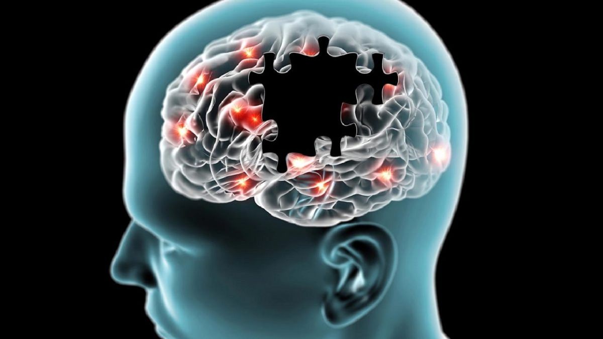  علت پیشرفت آلزایمر در مغز