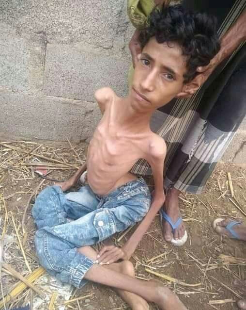 این کودکان هر روزشان هالووین است+عکس