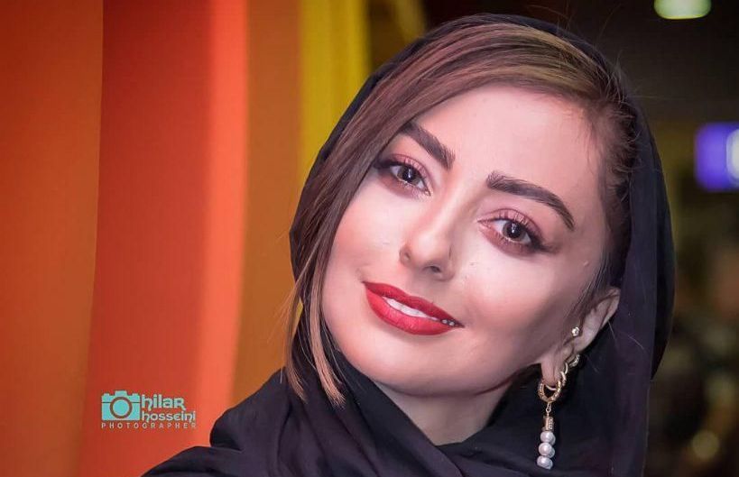 وضعیت بازیگر زن ایرانی پس از دزدیده شدن سگش+عکس