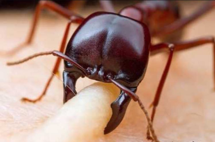 صحنه ترسناک گاز گرفتن مورچه از نمای نزدیک+عکس
