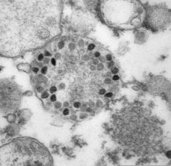 اولین تصویر میکروسکوپی از کرونای اومیکرون