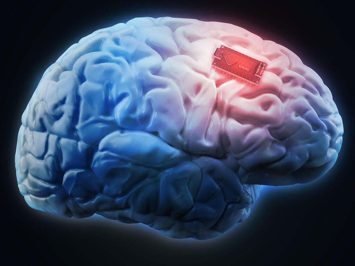 تغییر در رفتار و حرکات انسان با ایمپلنت های مغزی 
