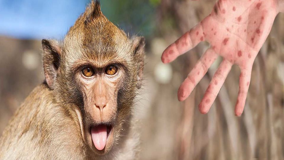 شیوه انتقال آبله میمون تغییر کرده است و دانشمندان دلیل آن را نمی دانند !