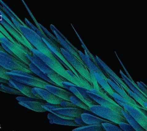 نمایی عجیب از پای پشه در زیر میکروسکوپ+عکس