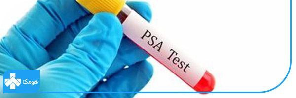 کنترل بیماری‌های پروستات + آزمایش Free PSA