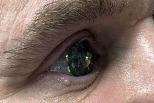  اولین لنز چشم هوشمند مجهز به واقعیت افزوده+عکس