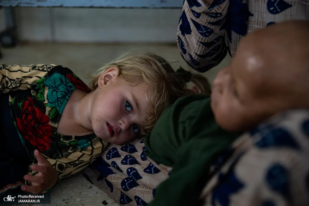 کودکان زیبای افغانستانی که دچار سوء تغذیه شده اند+عکس