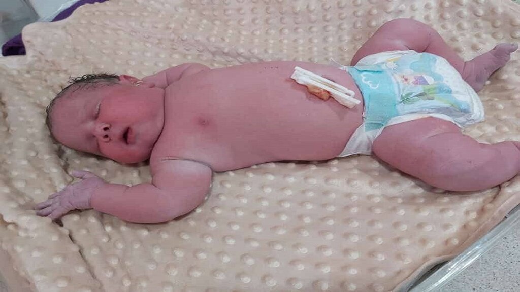 تولد نوزادی با وزن بالای 5 کیلوگرم+عکس