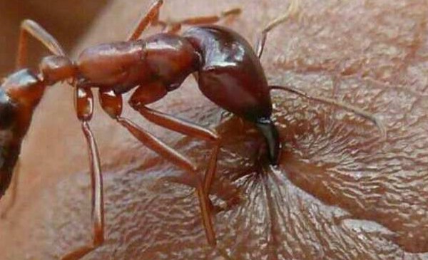 تصویر بی‌نظیر از لحظه گاز گرفتن مورچه‌ها+عکس