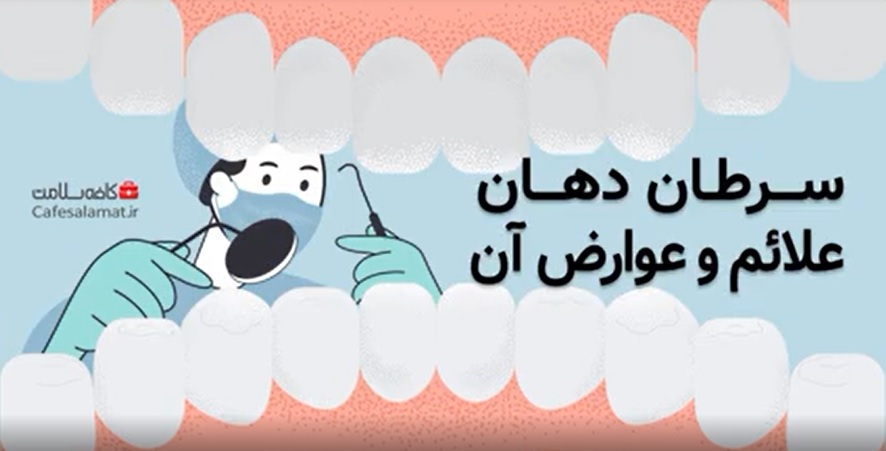سرطان دهان، علائم و عوارض آن