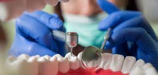جزئیات نوزدهمین آزمون ملی دانش آموختگان دندانپزشکی خارج از کشور