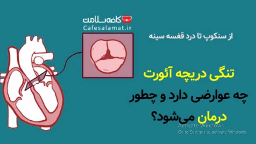 تنگی دریچه آئورت چه عوارضی دارد و چطور درمان می‌شود؟