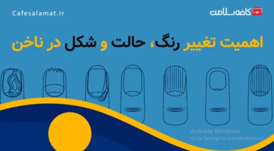 اهمیت تغییر رنگ، حالت و شکل در ناخن
