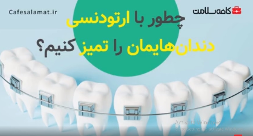 چطور با ارتودنسی، دندان‌هایمان را تمیز کنیم؟