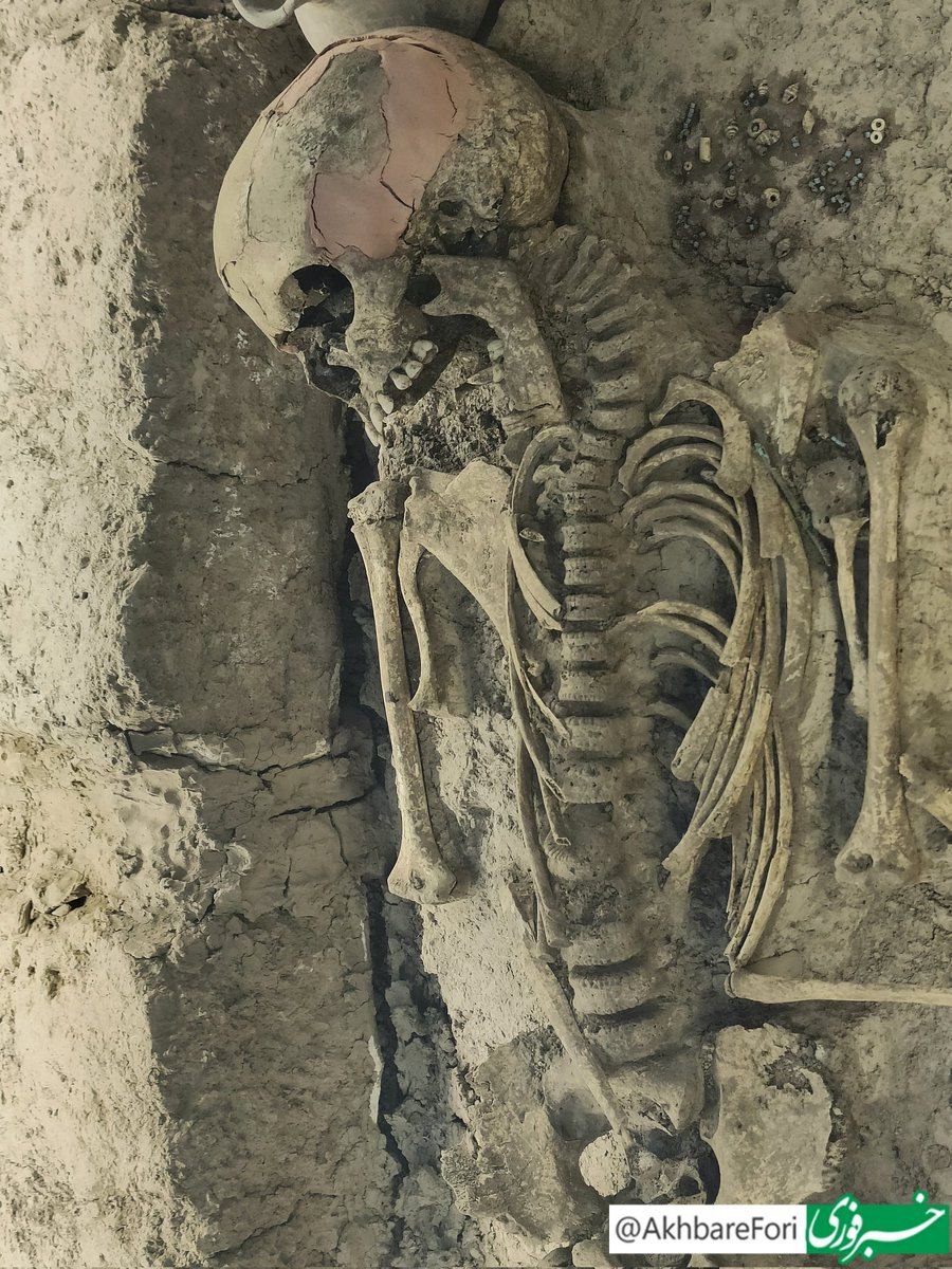 کشف اسکلت دختربچه ۳ هزار ساله در قزوین+عکس