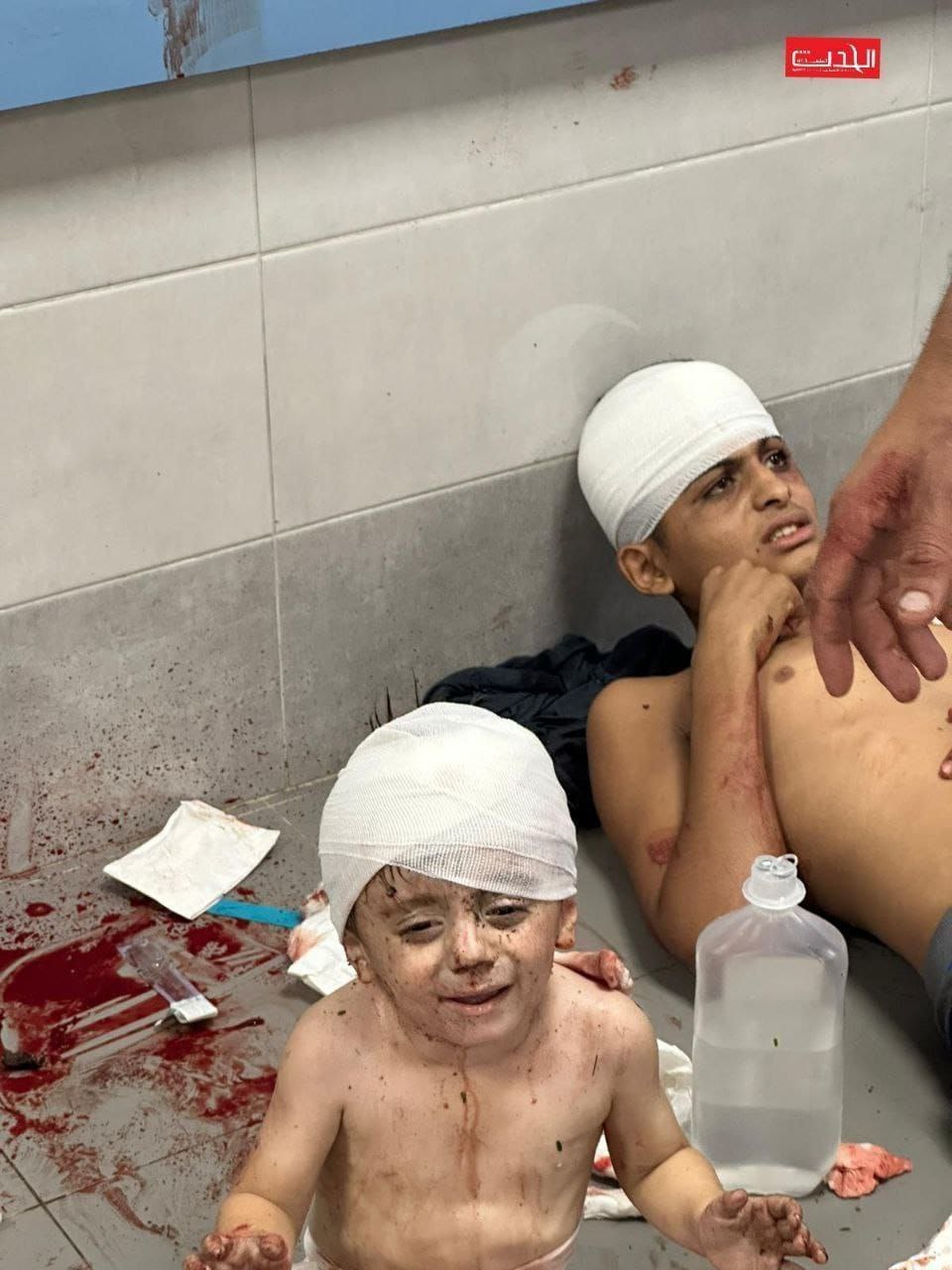 تصاویر دردناک از حمله به بیمارستان غزه+عکس