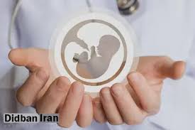 بارداری پس از ۱۸ سال به کمک هوش مصنوعی