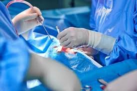 تعویض دریچه قلب بدون باز کردن قفسه سینه برای اولین بار در جهان