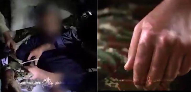 دست‌های سوخته پاسداران و حافظان امنیت کشور درجنگ ۱۲ روزه