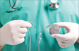 پایان باتری و آغاز ایمپلنت‌های بی‌سیم در جراحی پزشکی