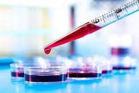 خون پیر، پیشرفت آلزایمر را تسریع می‌کند