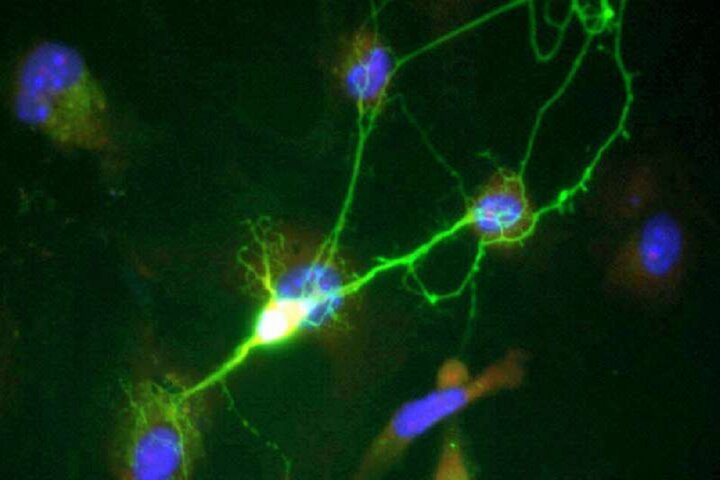 جلوگیری از مرگ نورون‌ها در آلزایمر با یک داروی رایج