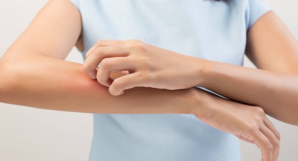 خارش بدن نشانه کدام بیماری های خطرناک است؟