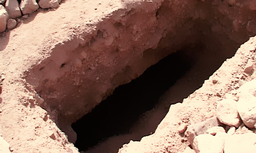 وضعیت عجیب یک زن بیمار پس از مرگ! +عکس