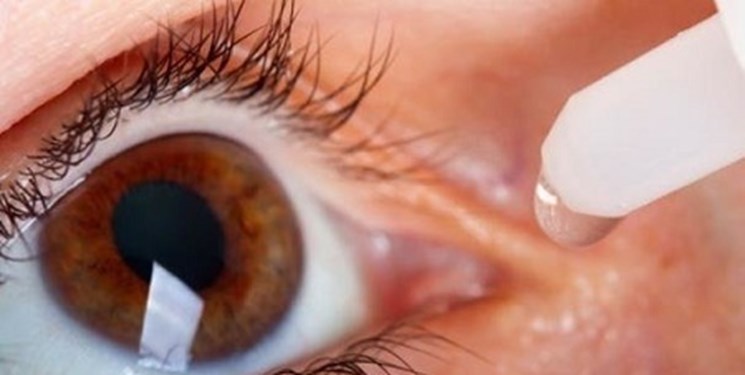 کشف بیش از ۳۰۰ ژن مرتبط با بیماری‌های چشمی ارثی