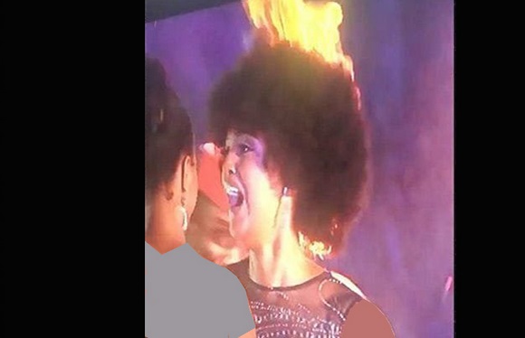 ملکه زیبایی روی صحنه آتش گرفت و سوخت!+عکس