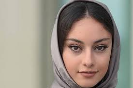 جراحی چشم گربه‌ای ترلان پروانه در کودکی! +عکس