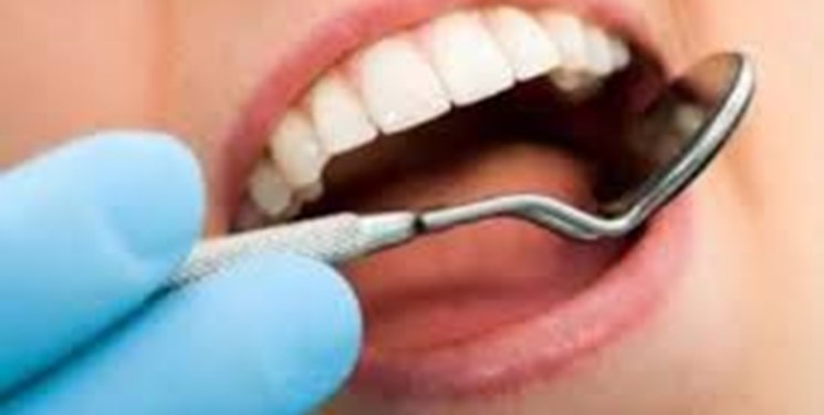 مصرف زیاد فلوراید و خمیردندان علت ایجاد لکه بر روی مینای دندان 