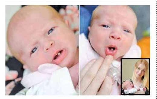این دختر با یک دندان بزرگ به دنیا آمد +عکس