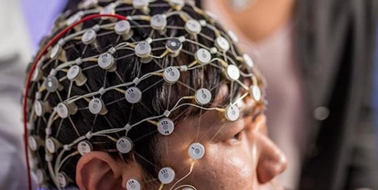 درمان افسردگی با تحریک مغز