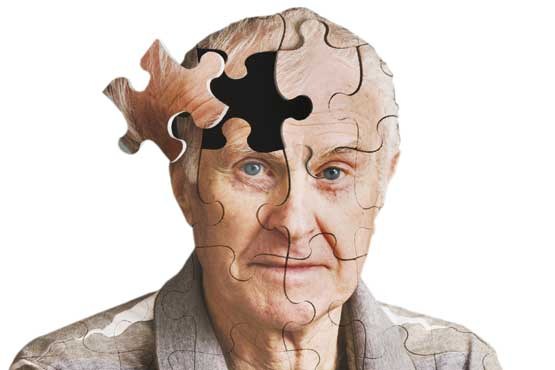 تشخیص آلزایمر ۳۰ سال قبل از بروز علائم اولیه