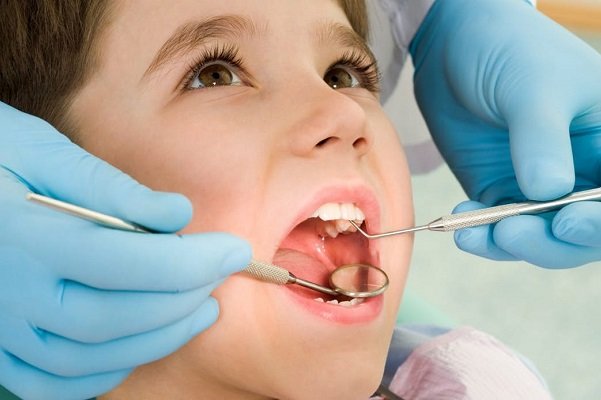 پوسیدگی دندان شایع‌ترین بیماری میکروبی در کودکان