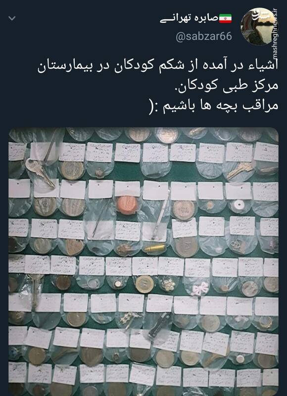 فِشنگ، سکه و کلید در شکم کودکان ایرانی  + عکس