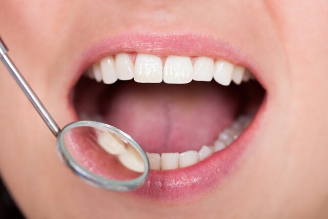 ارتباط مستقیم بیماری دهانی پیوره با فشار خون بالا