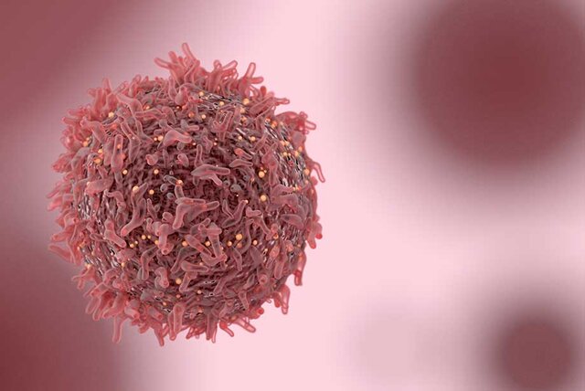 از بین بردن سلول‌های مقاوم سرطان سینه با یک ترکیب دارویی جدید 