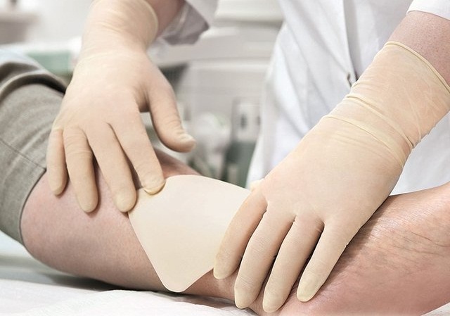 افزایش قابلیت آنتی باکتریایی باندهای سوختگی با نانو ذرات