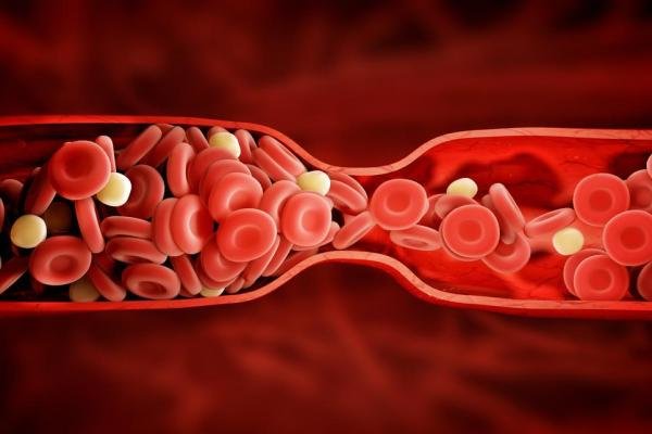 تستوسترون درمانی احتمال لختگی خون در مردان را افزایش می‌دهد