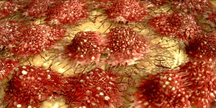نحوه نجات سلول‌های ایمنی در زمان تهاجم سرطان آشکار شد