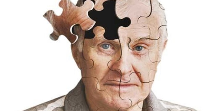 مقابله با آلزایمر از طریق مهار پالس‌های رگ‌های خونی