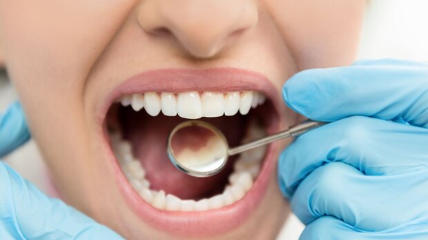 دندان‌های تمیزتر به معنای قلب سالم‌تر