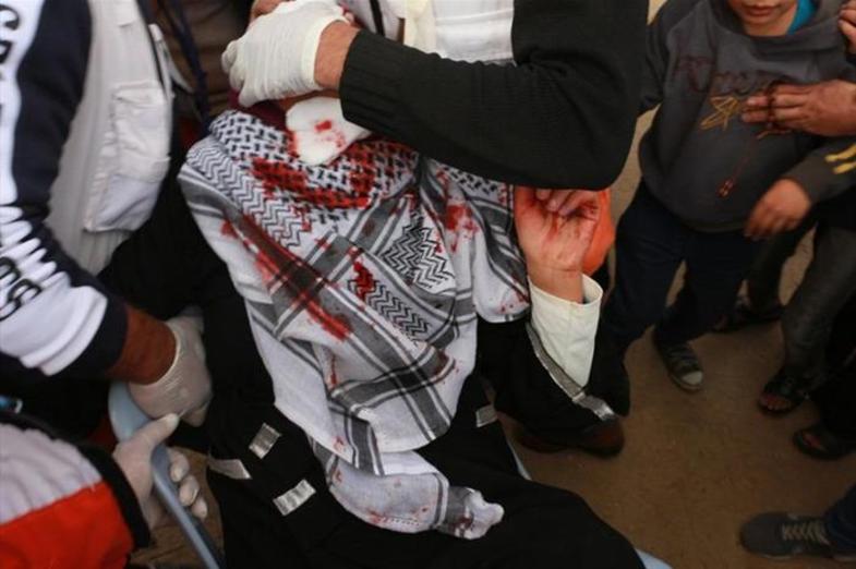 سرباز صهیونیست چشم دختر فلسطینی را درآورد +عکس