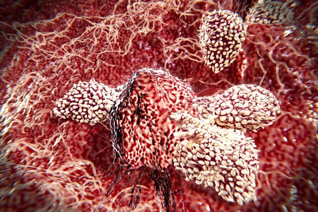 کشف یک سلول ایمنی جدید و امیدبخش برای درمان سرطان