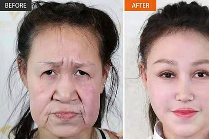 جراحی زیبایی این پیرزن را به دختر ۱۵ ساله تبدیل کرد +عکس 